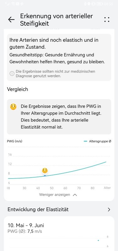 HUAWEI Watch GT 3 Pro Firmware Übersicht 30 HUAWEI Watch GT 3 Pro Firmware Arteriosklerose